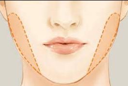 بوکال فت-وبسایت دکتر شهرام مفاضی